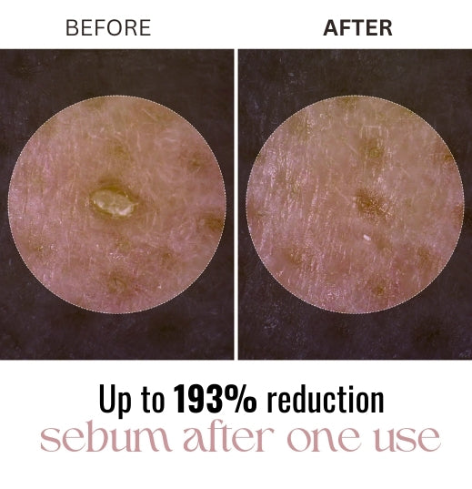 Radiant Glow Rice Peeling Ampoule