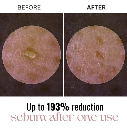 Radiant Glow Rice Peeling Ampoule